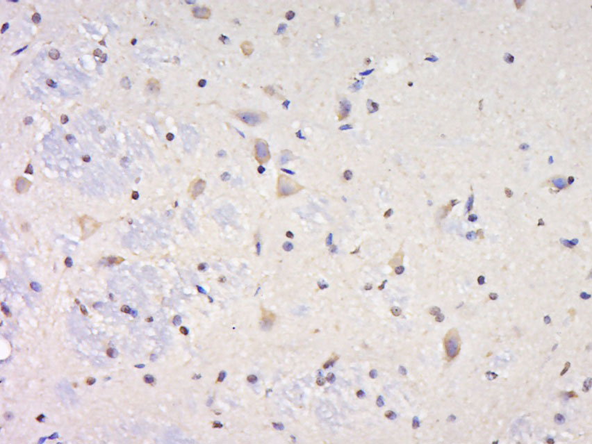 14 - SYNPR/Synaptoporin Rabbit pAb AP52298