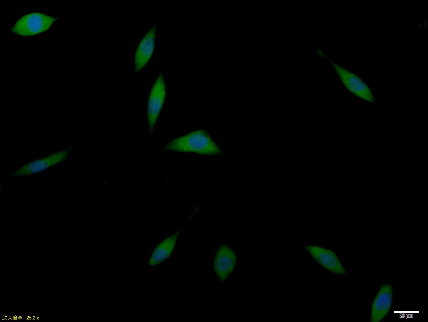 0 - GLUT12 Rabbit pAb AP52299