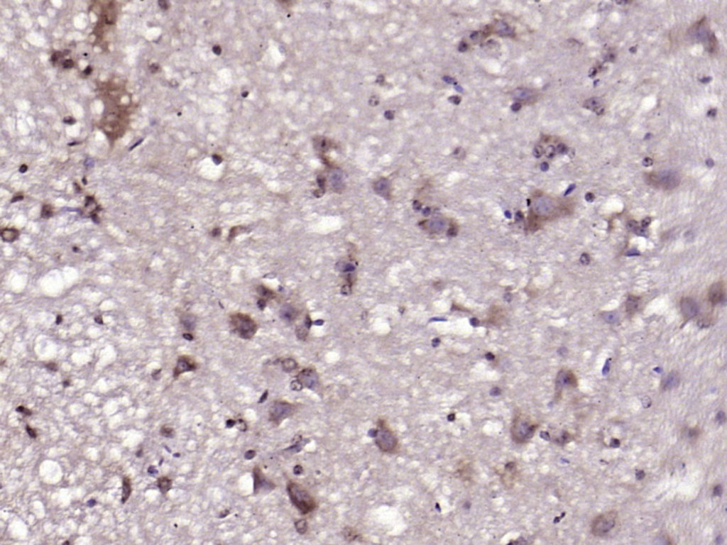 14 - GLUT12 Rabbit pAb AP52299