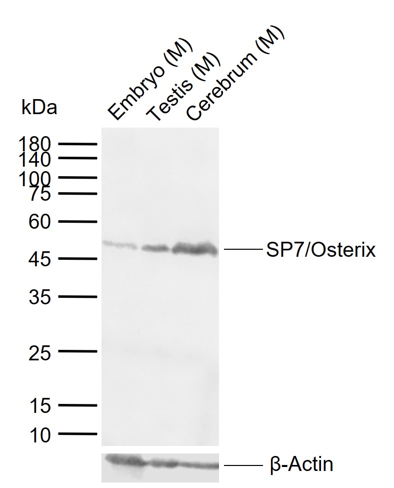 1 - SP7/Osterix Rabbit pAb AP52300