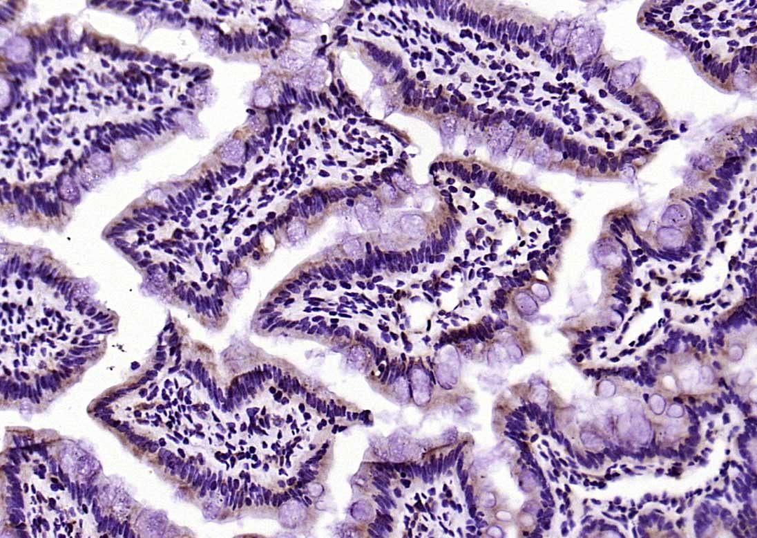 14 - PEPT1 Rabbit pAb AP52305