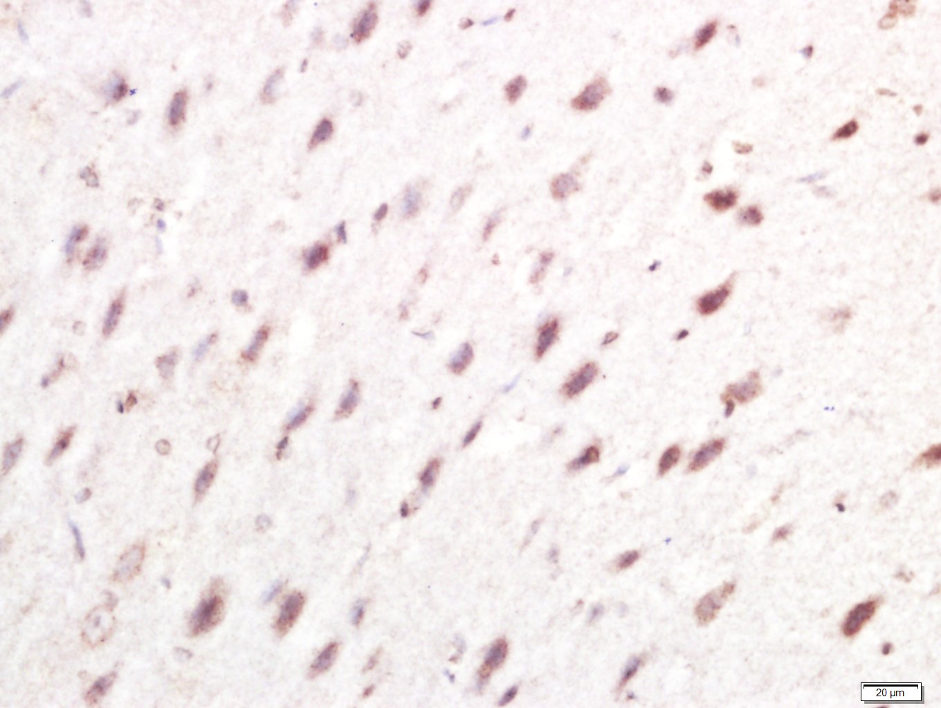 14 - IRF7 Rabbit pAb AP52307