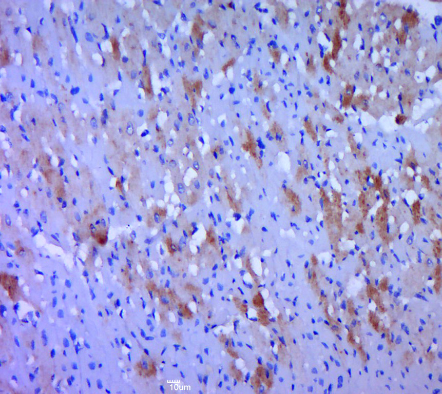 14 - WNT2B Rabbit pAb AP52308