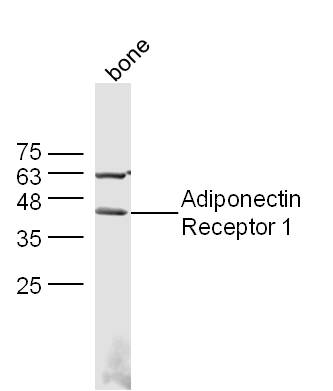 1 - Adiponectin Receptor 1 Rabbit pAb AP52309