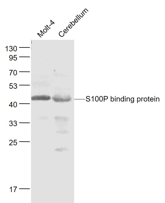 1 - S100P binding protein Rabbit pAb AP52310