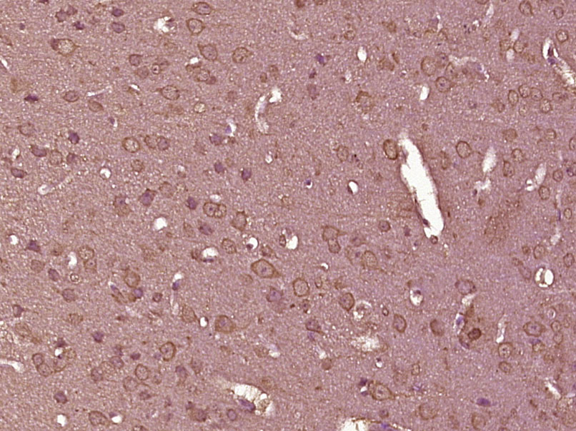 14 - TLR3 Rabbit pAb AP52313