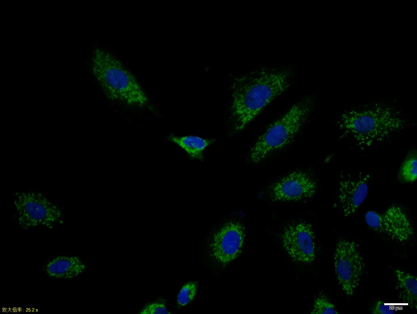 0 - CK7 Rabbit pAb AP52316
