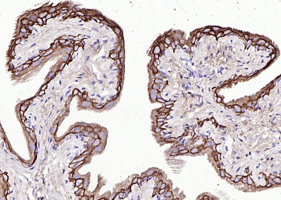 14 - CK7 Rabbit pAb AP52316