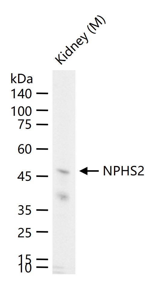 1 - NPHS2 Rabbit pAb AP52326