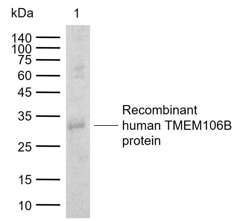 1 - TMEM106B Rabbit pAb AP52330