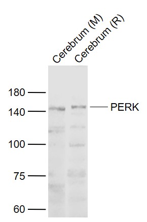 1 - PERK Rabbit pAb AP52332