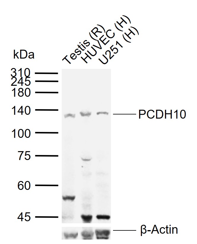 1 - PCDH10 Rabbit pAb AP52333