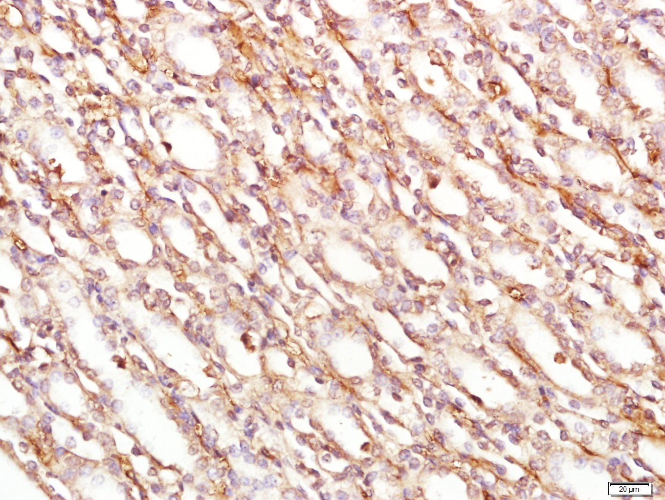 14 - PCDH10 Rabbit pAb AP52333