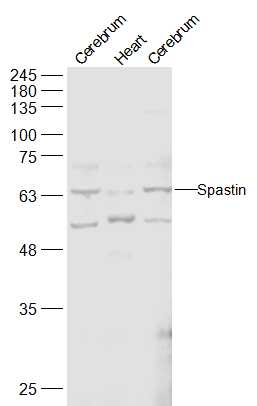 1 - Spastin Rabbit pAb AP52337