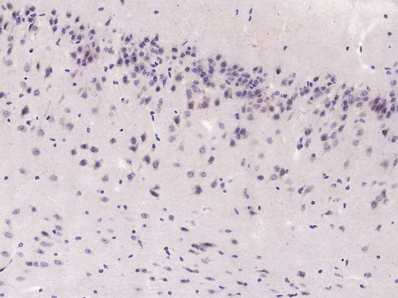 14 - GAB2 Rabbit pAb AP52339