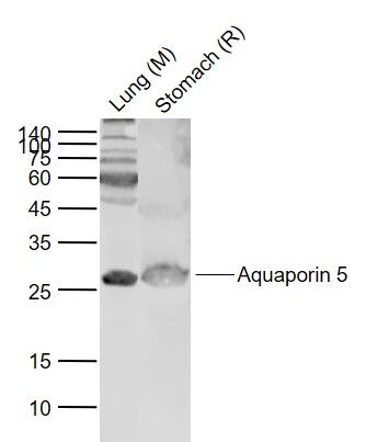 1 - Aquaporin 5 Rabbit pAb AP52340