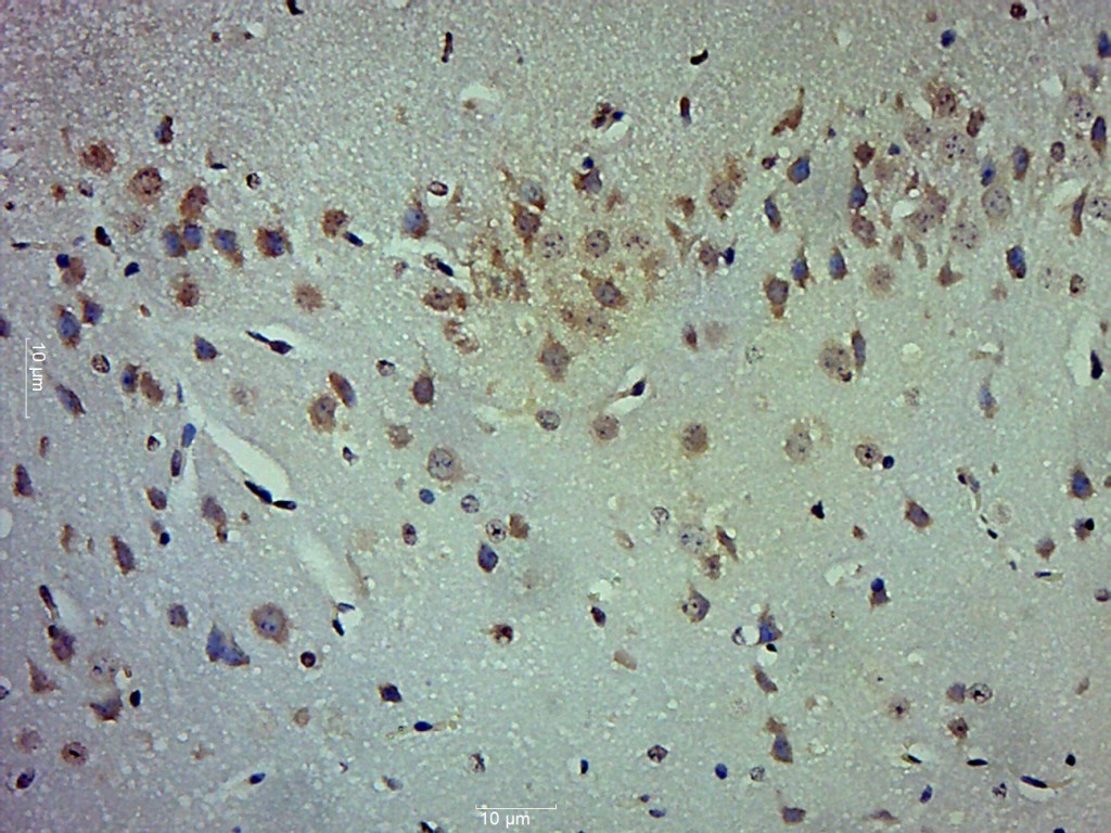14 - LOX 1 Rabbit pAb AP52341