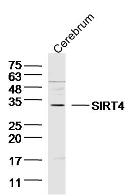 1 - SIRT4 Rabbit pAb AP52344