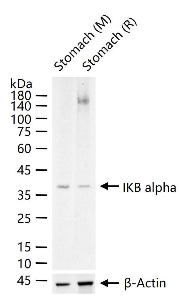 1 - IKB alpha Rabbit pAb AP52345