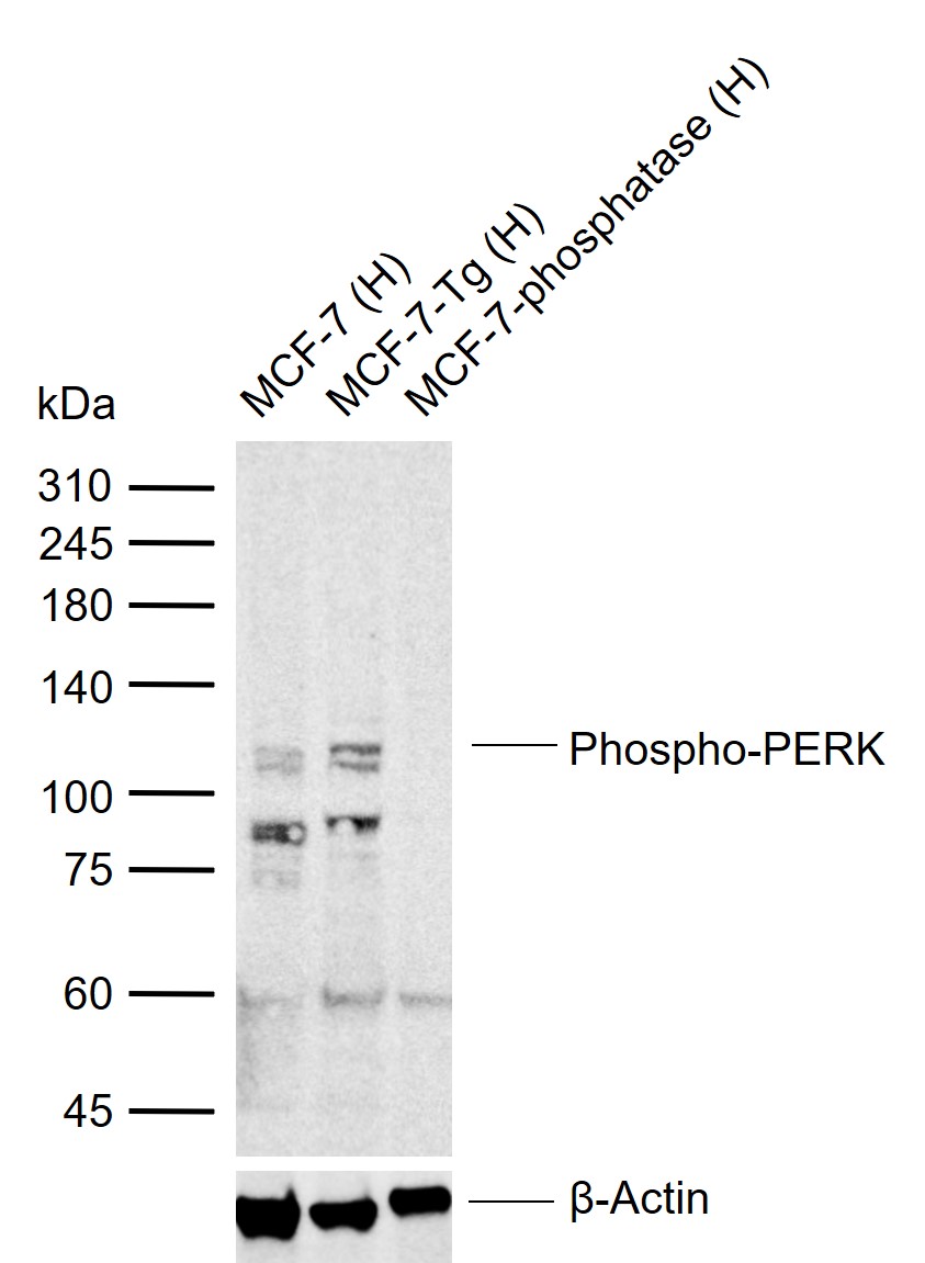 1 - phospho-PERK (Thr980) Rabbit pAb AP52346