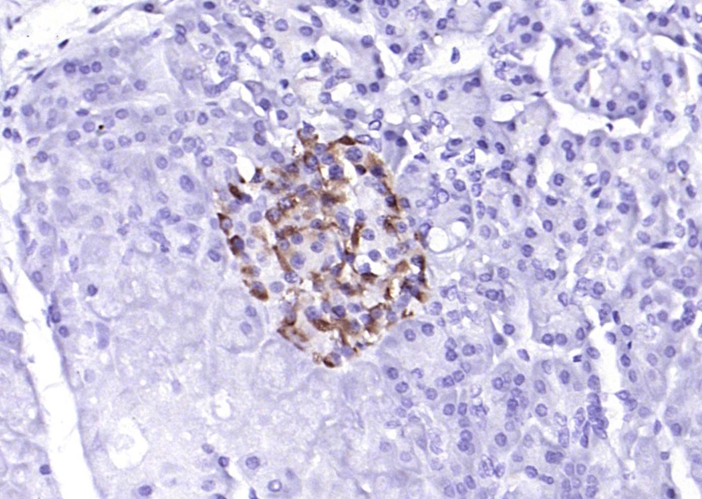 14 - phospho-PERK (Thr980) Rabbit pAb AP52346