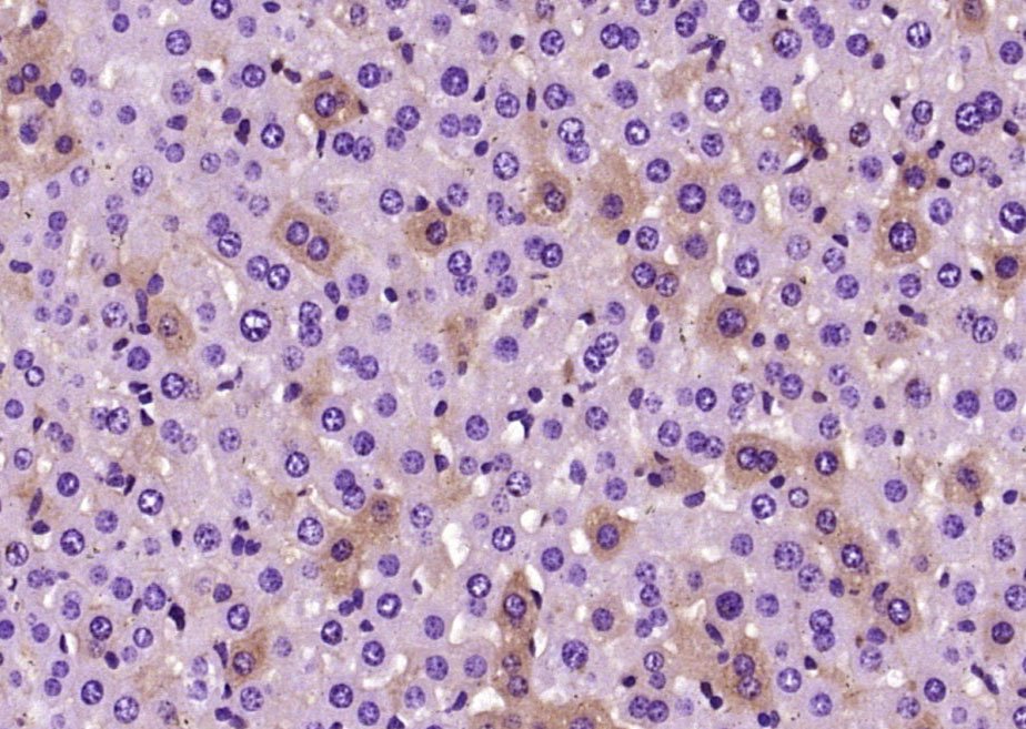 14 - presenilin 1 Mouse pAb AP54178