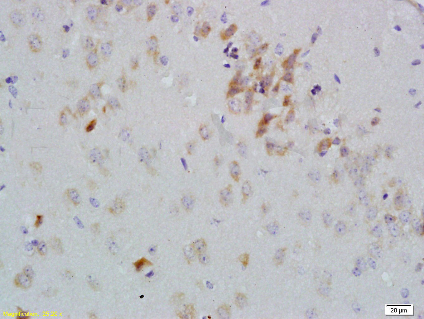 14 - GDNF Receptor alpha 2 Rabbit pAb AP54180