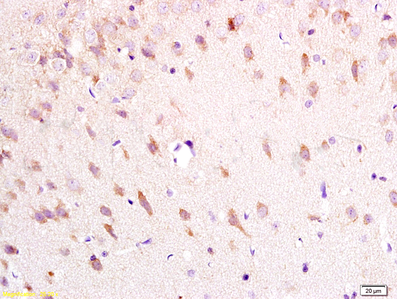 14 - Neurokinin A Receptor Rabbit pAb AP54183