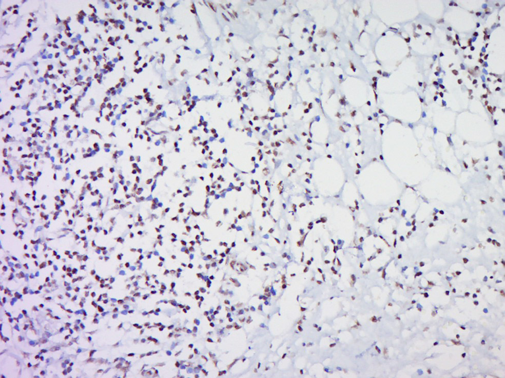 14 - HOXc8 Rabbit pAb AP54196