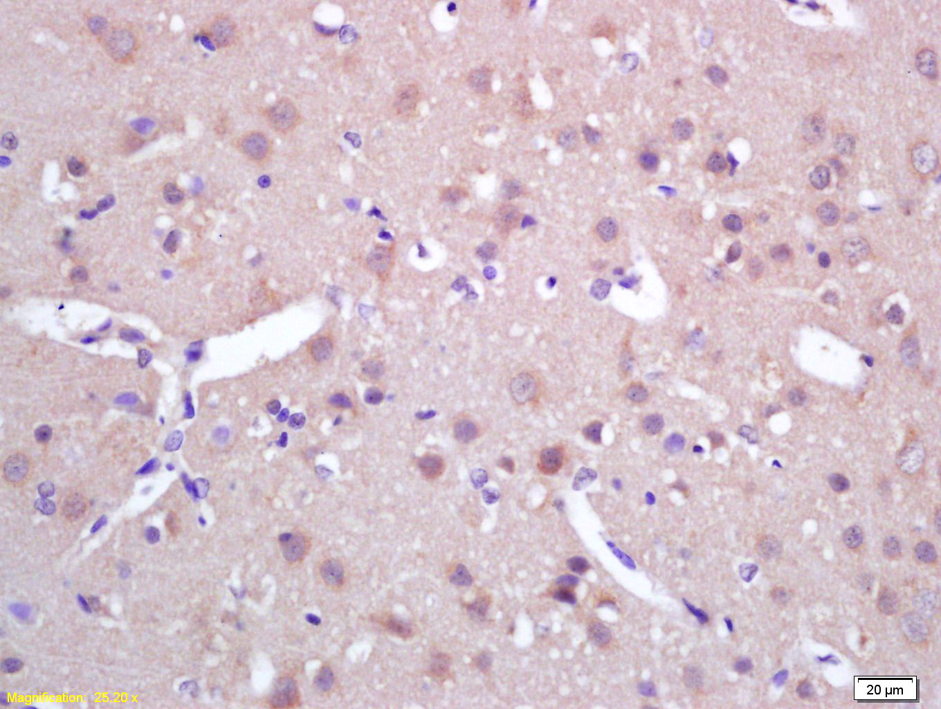 14 - MAP126 Rabbit pAb AP54205