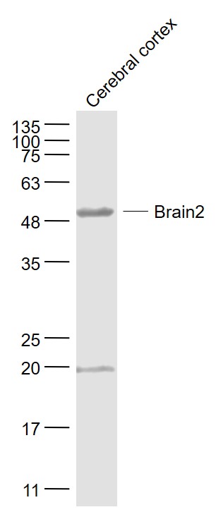 1 - Brain2 Rabbit pAb AP54226