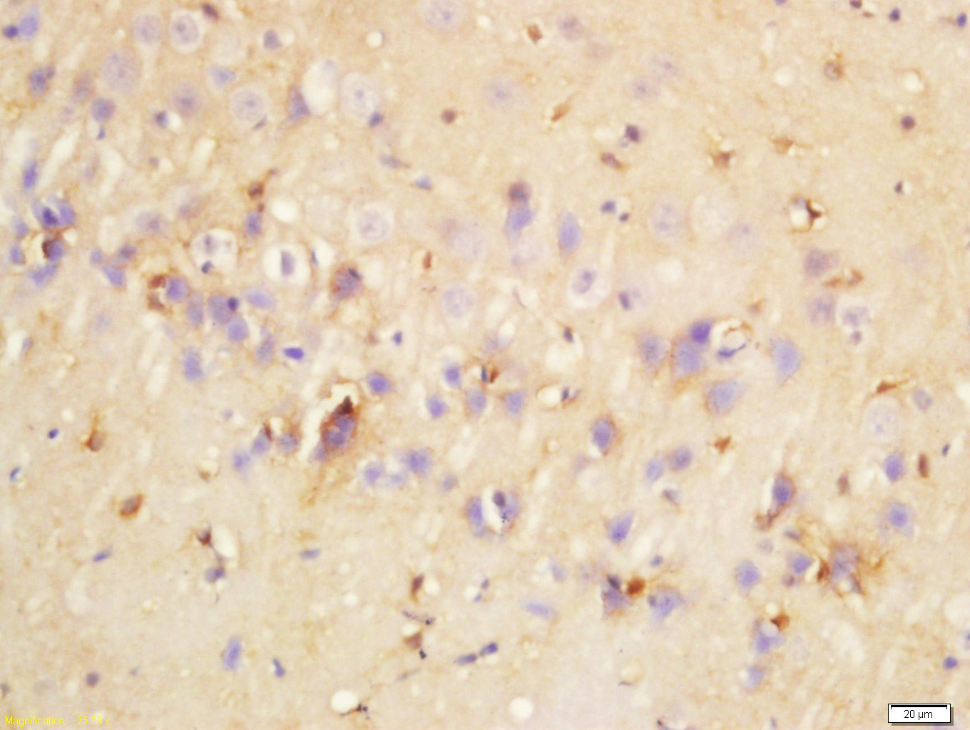 14 - SCNN1D Rabbit pAb AP54227