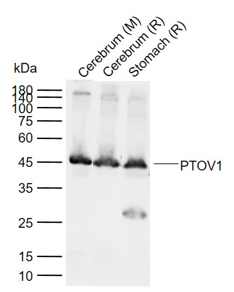 1 - PTOV1 Rabbit pAb AP54231