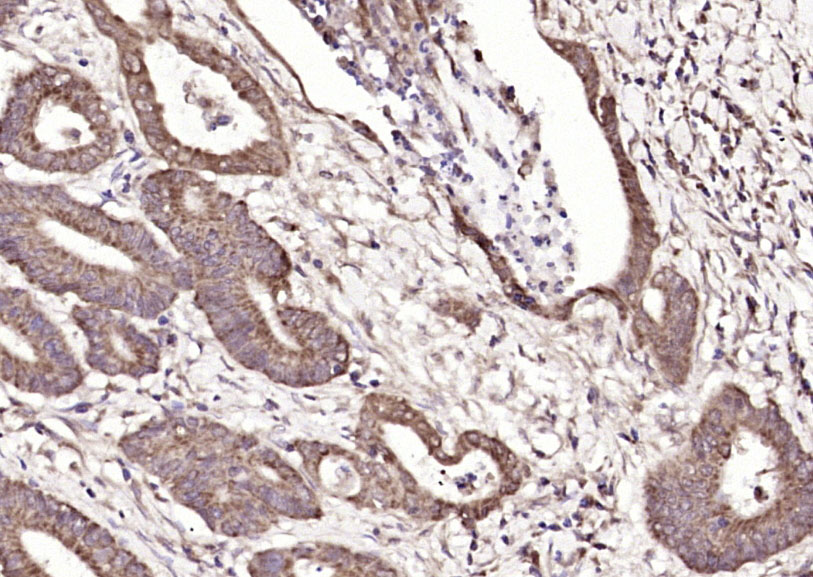 14 - PTOV1 Rabbit pAb AP54231