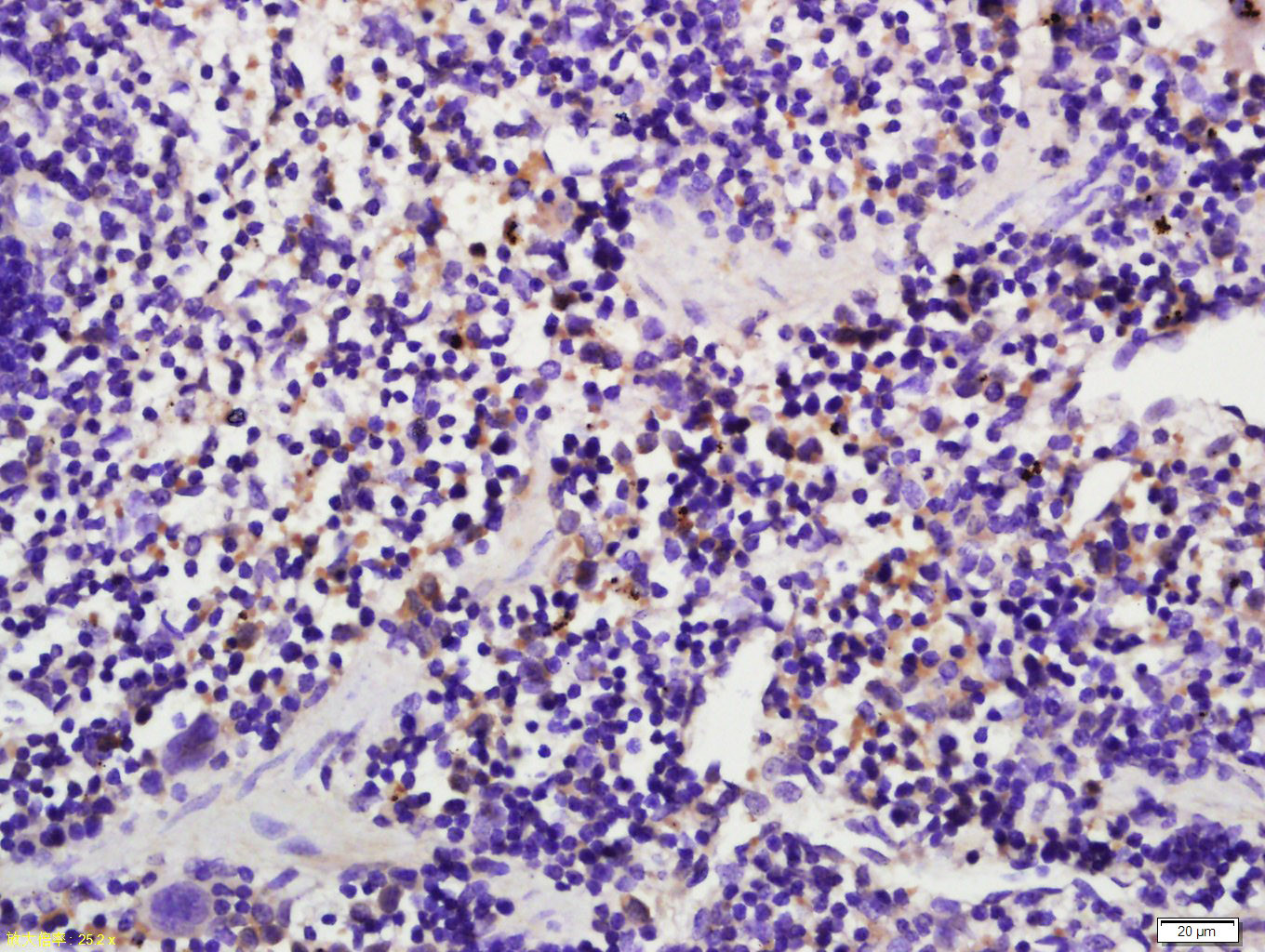 14 - Caspase-1 p20 Rabbit pAb AP54266