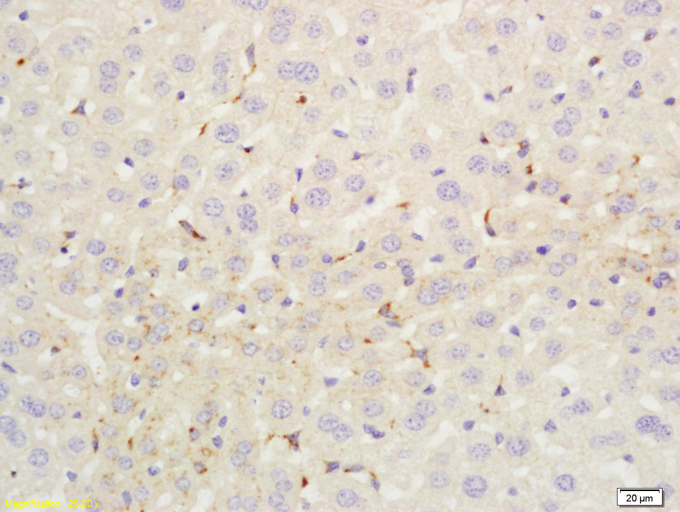 14 - C4d-A Rabbit pAb AP54268