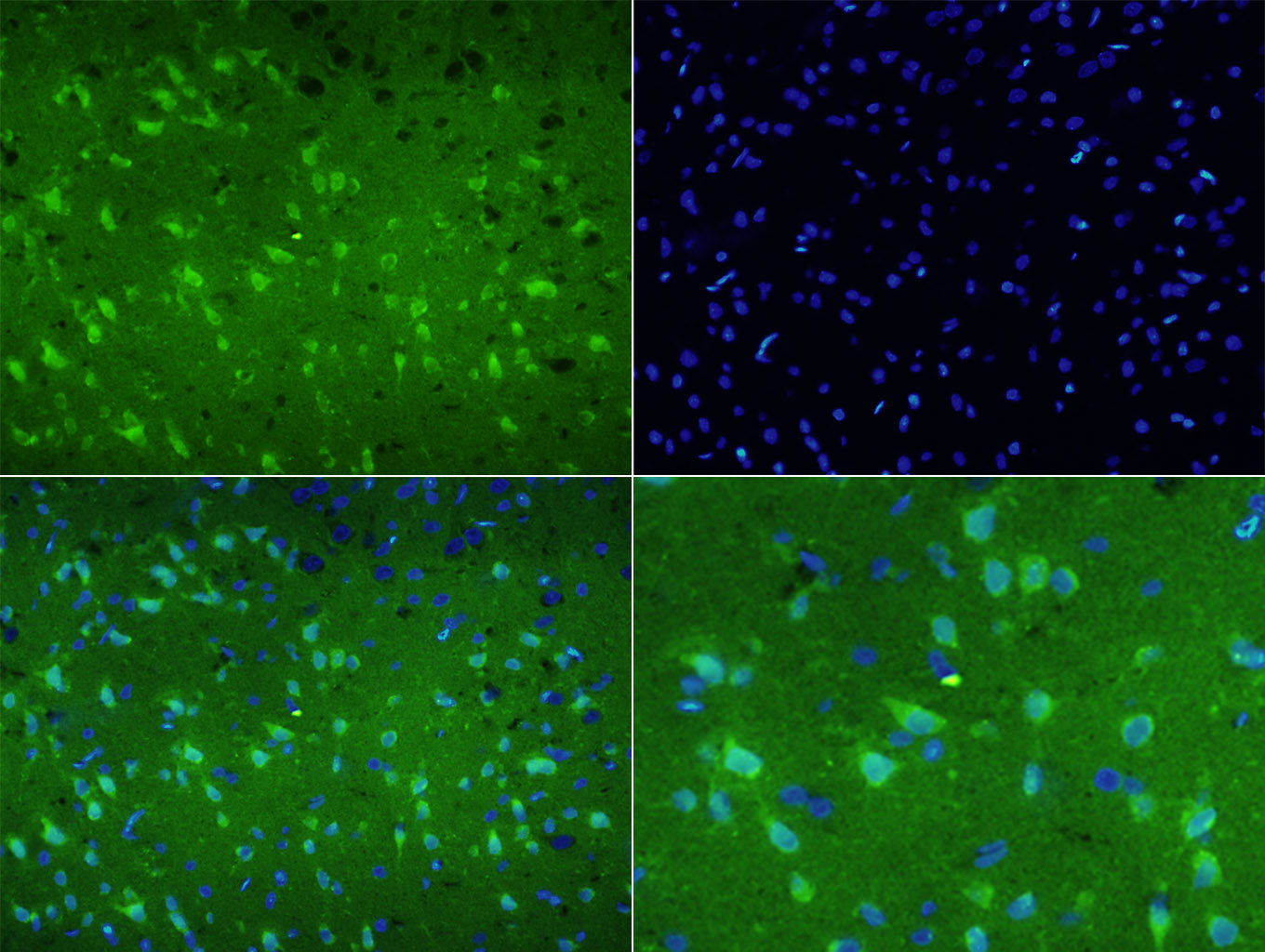 3 - DYNC1I1 Rabbit pAb AP54269
