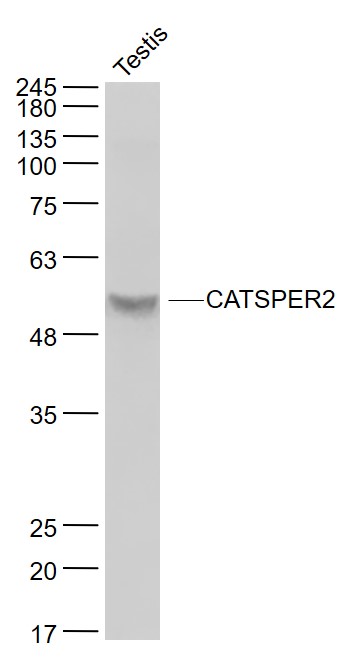 1 - CATSPER2 Rabbit pAb AP54271