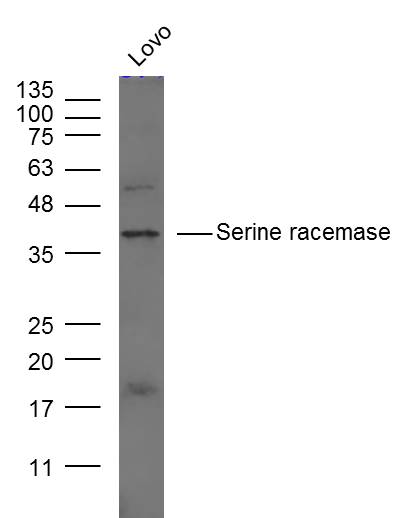 1 - Serine racemase Rabbit pAb AP54272