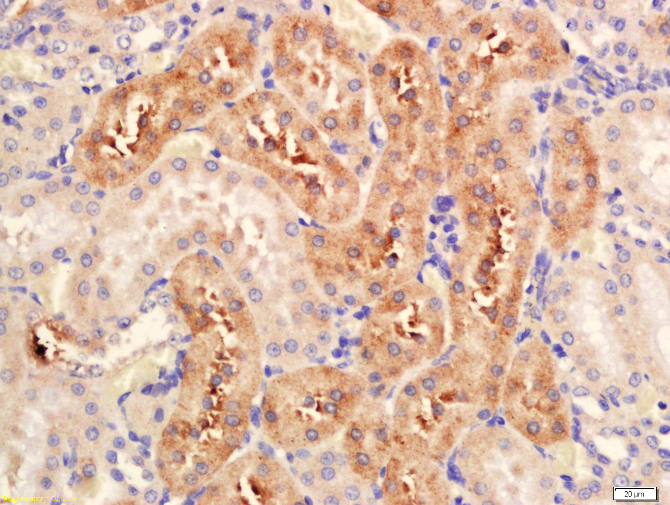 14 - Serine racemase Rabbit pAb AP54272