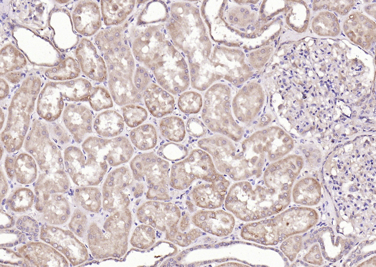 14 - Cathepsin L(heavy chain) Rabbit pAb AP54282