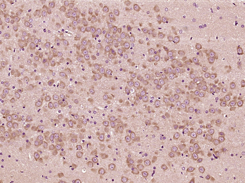 14 - DRD1 Rabbit pAb AP54292