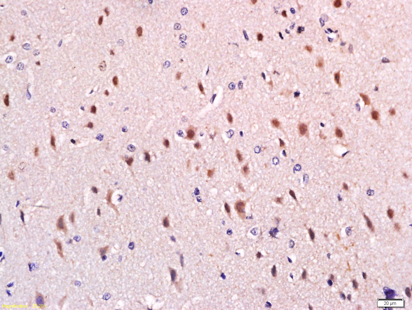 14 - SPTBN2 Rabbit pAb AP54313