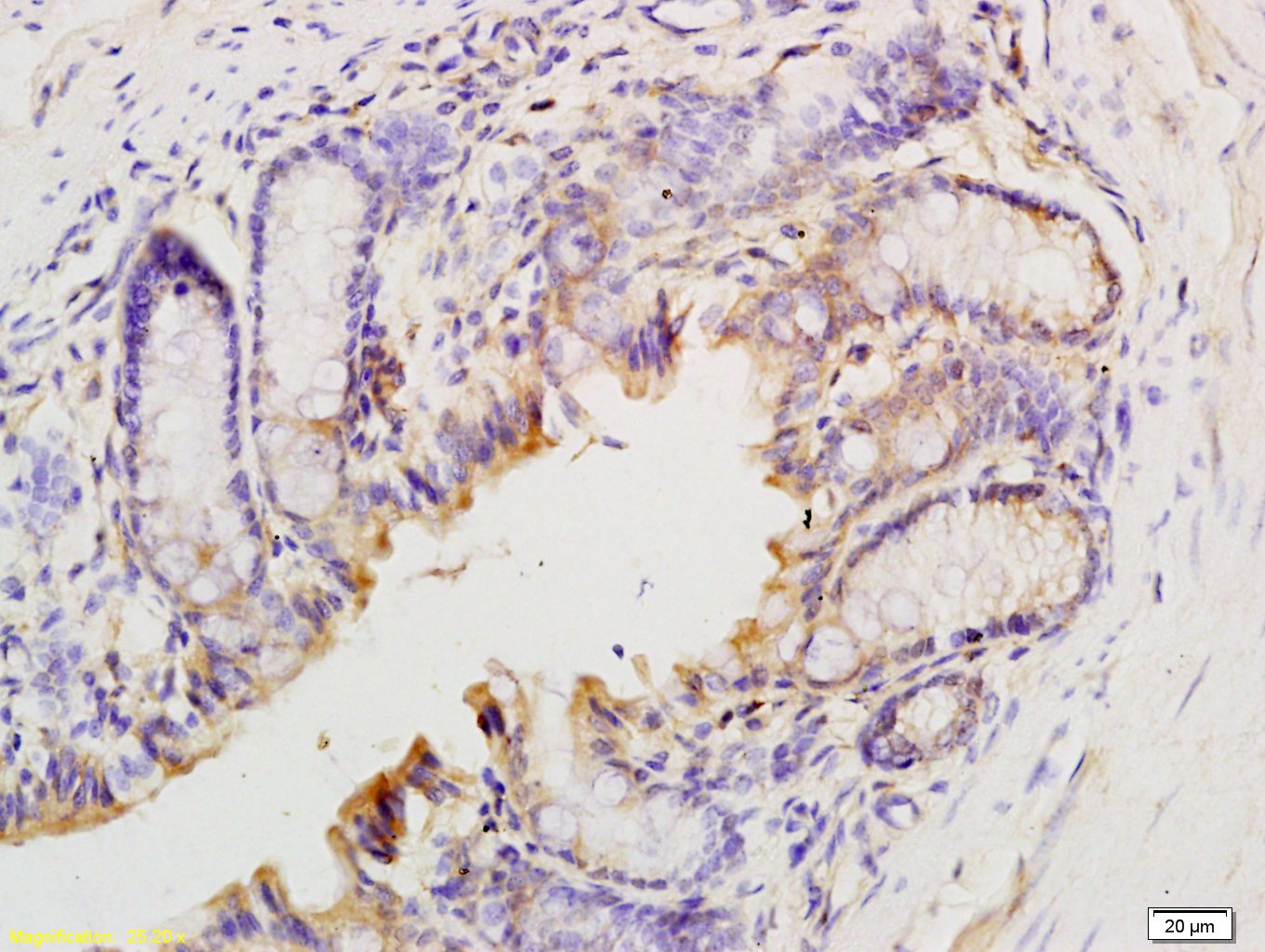 14 - T Beta 10 Rabbit pAb AP54316