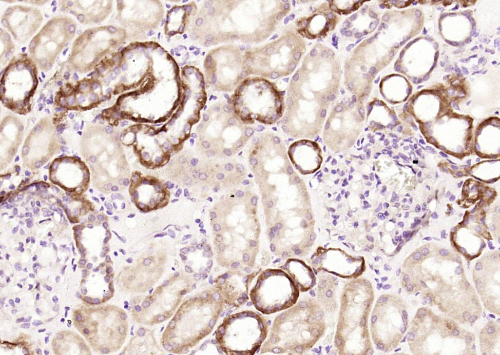 14 - CCBL1 Rabbit pAb AP54327