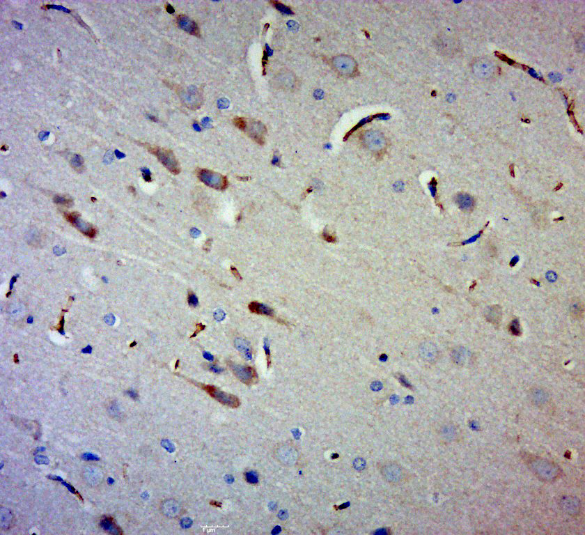 14 - Gigaxonin Rabbit pAb AP54346
