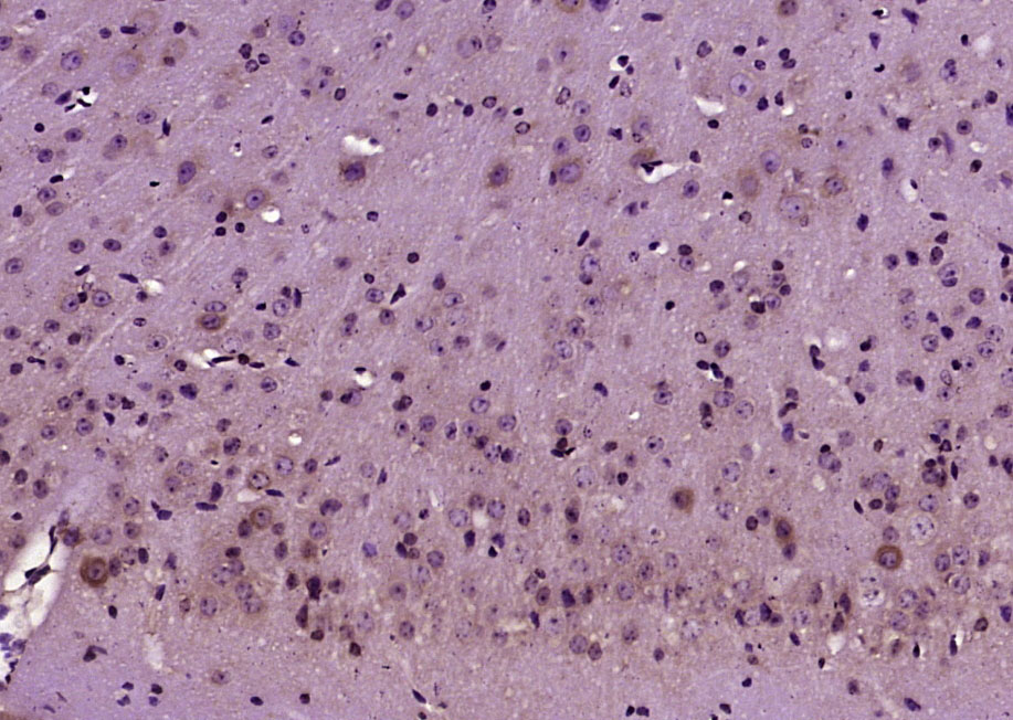 14 - KIF5A/NKHC1 Rabbit pAb AP54347