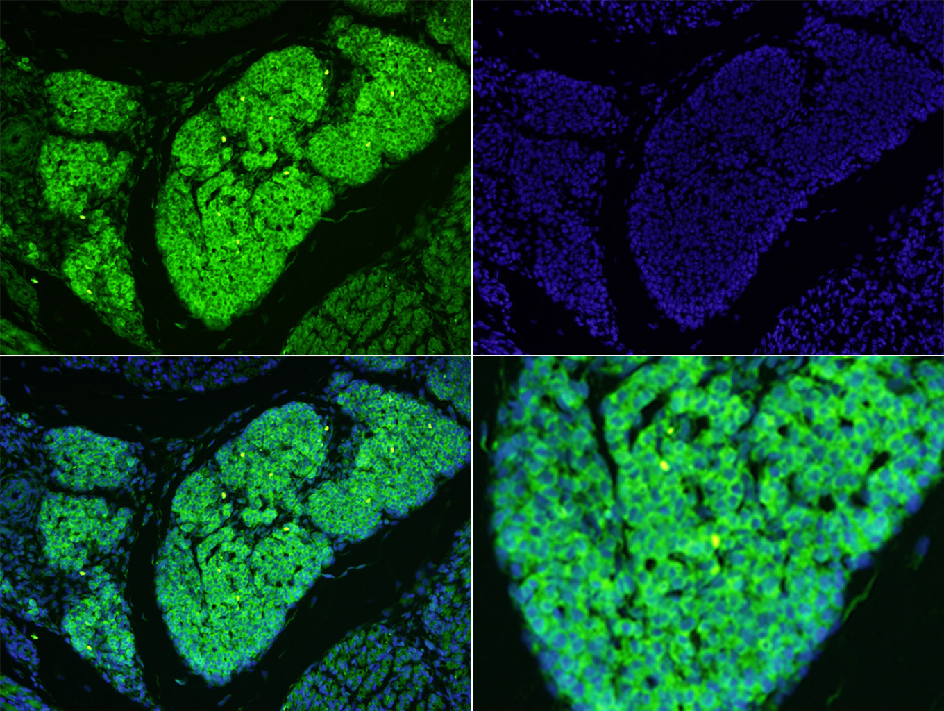 3 - MAP1B Rabbit pAb AP54348
