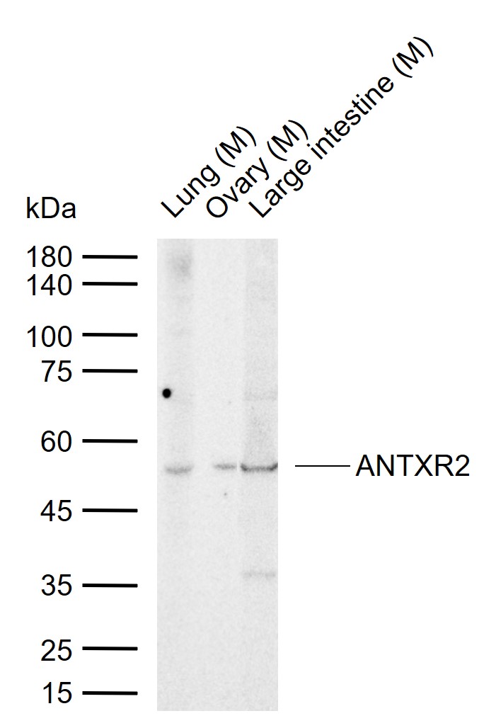 1 - ANTXR2 Rabbit pAb AP54361