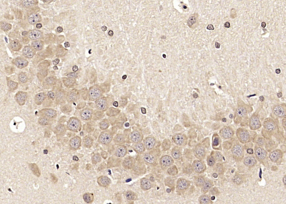 14 - LRFN2 Rabbit pAb AP54365
